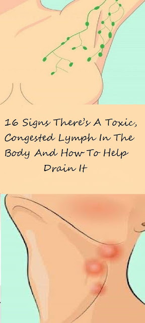 16 Signs There’s A Toxic, Congested Lymph In The Body And How To Help Drain It