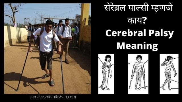 Cerebral Palsy Meaning In Marathi