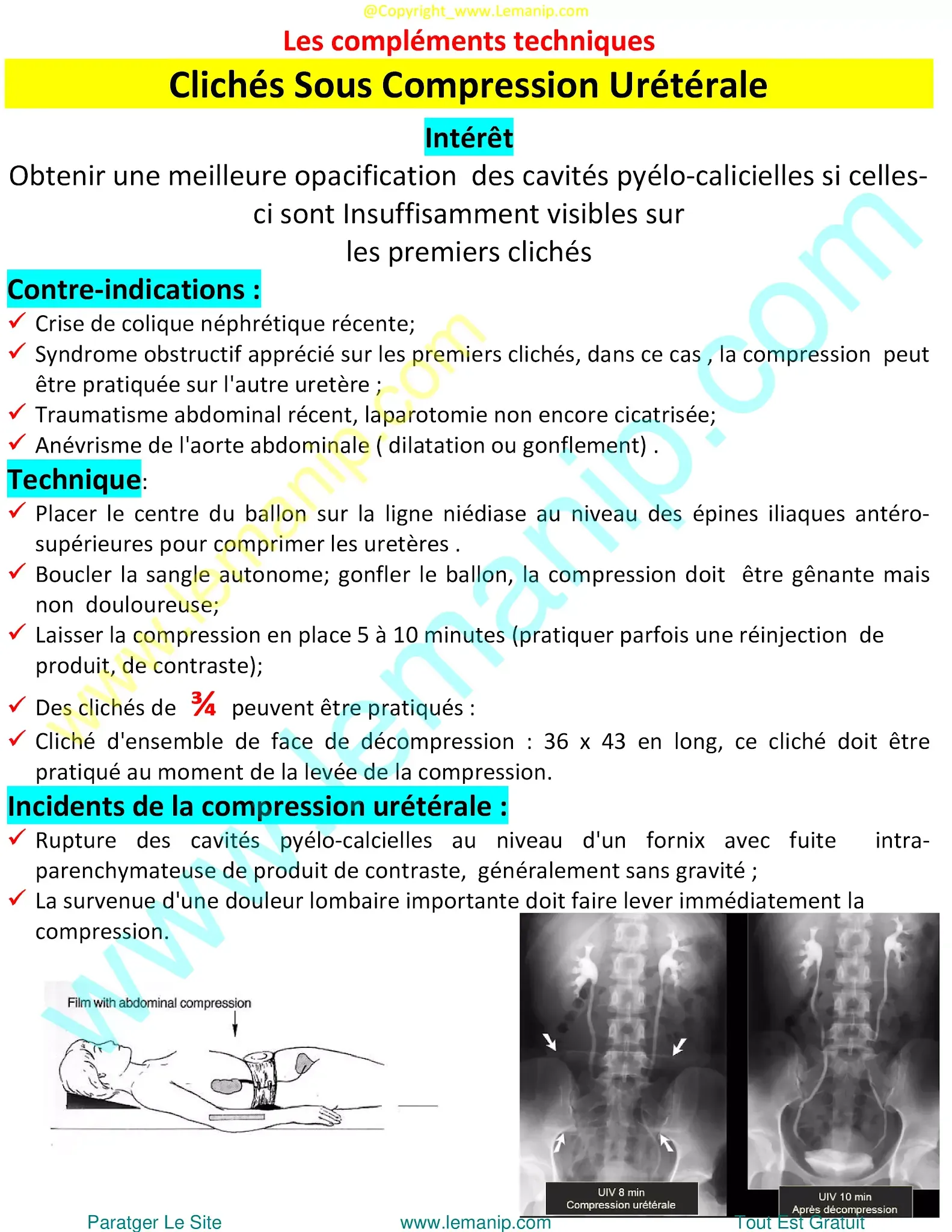 Clichés Sous Compression Urétérale