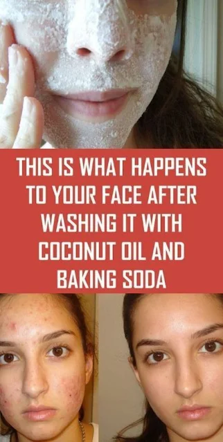 This Is What Happens To Your Face After You Wash It With Coconut Oil And Baking Soda