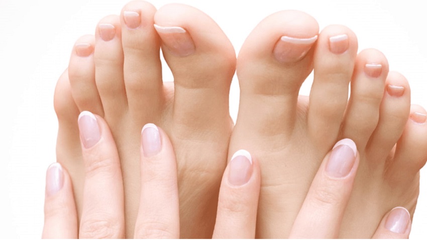 Nail Fungus Infection - Causes, Prevention, Treatments
