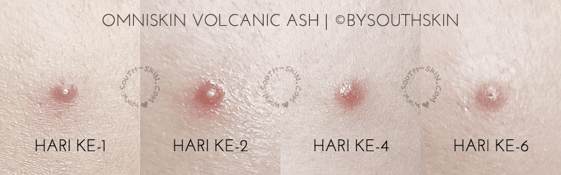 review-omniskin-volcanic-ash-pimple-drying-lotion