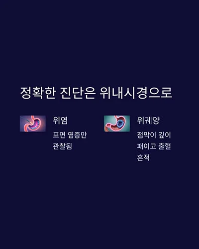 진단은 위내시경으로