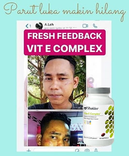 Testimoni Review Vitamin E Shaklee Untuk Wanita dan Lelaki