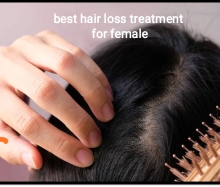 best hair loss treatment for female