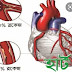 হার্ট রোগে হোমিপ্যাথিক ঔষধ