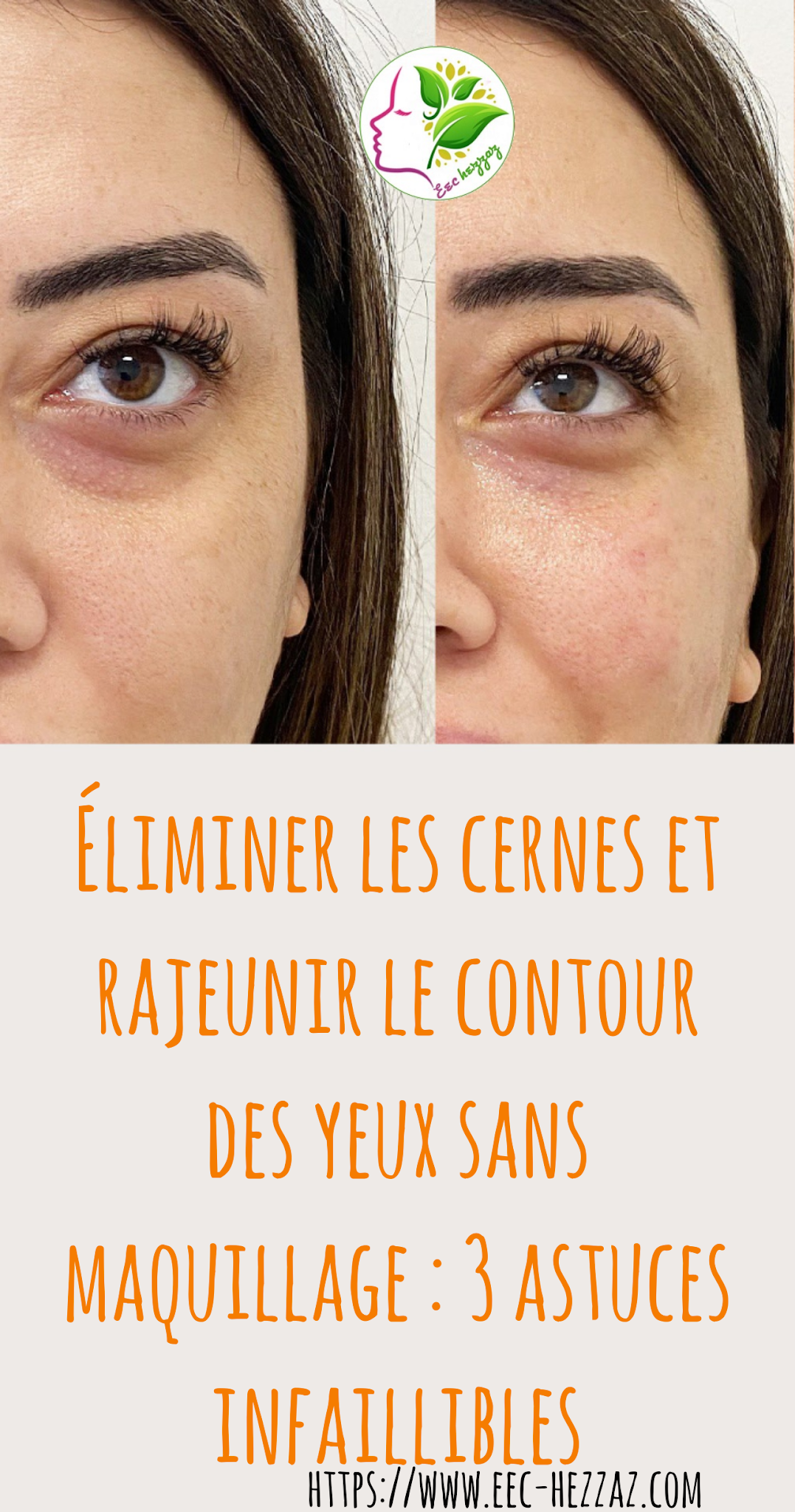 Éliminer les cernes et rajeunir le contour des yeux sans maquillage : 3 astuces infaillibles