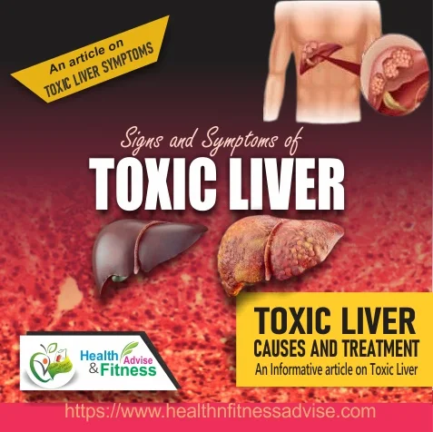 liver-toxicity-treatment-healthnfitnessadvise-com