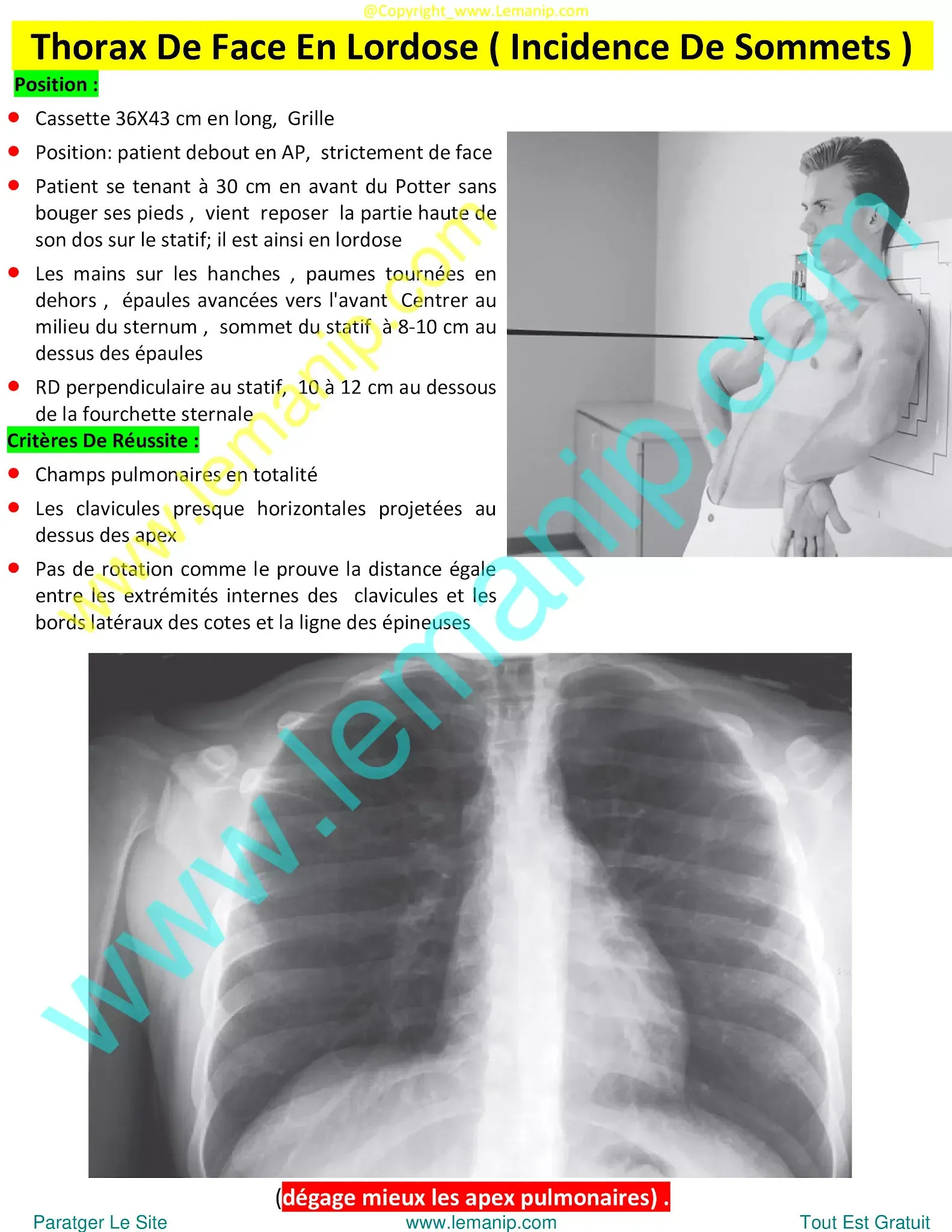mesothelioma chest x ray,asbestos lung x ray,asthma chest x ray,asthma lungs x ray,urgent care with chest x ray near me,chest xray pa and lateral,ppd chest x ray,chest xray tb,chest x ray pa and lateral,chest xray pa lateral