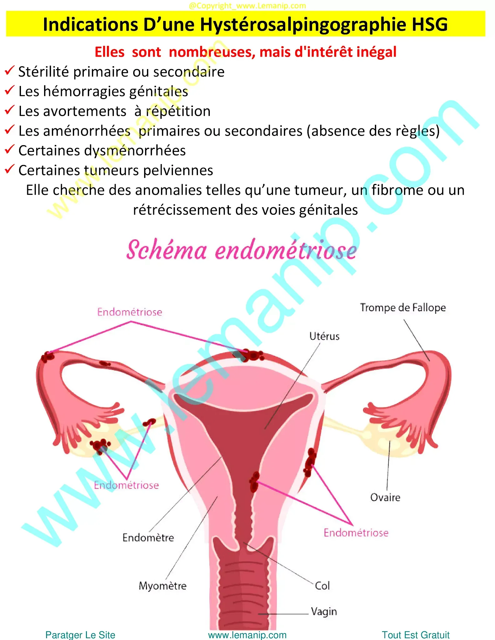 hysterosalpingography preparation,genetic testing female infertility,fl hysterosalpingography,xr hysterosalpingography,best female fertility test,camp lejeune infertility,female fertility clinic,women's infertility clinic,women's fertility clinic,fertility clinic for women