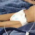 Menina de 3 anos deixada pelo pai 40 dias sem comer não consegue beber água
