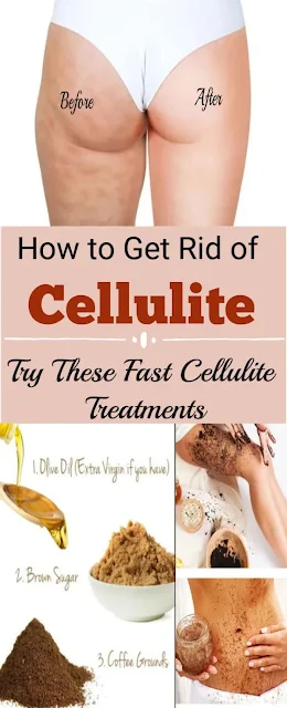 Get Rid of Cellulite Fast and Naturally