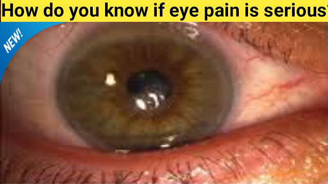 eye pain,How can I relieve eye pain?,Is eyeball pain a symptom of Covid?,your eye pain is serious?,What usually causes eye pain?