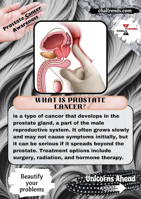 Prostate cancer illustration