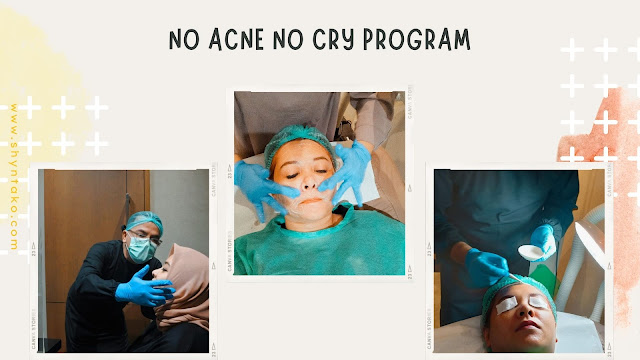 no-acne-no-cry