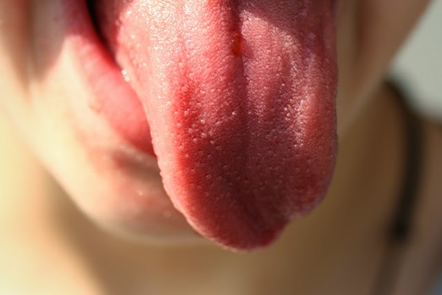 What should be the color of the tongue?  jeebh ka rang kaisa hona chahiye