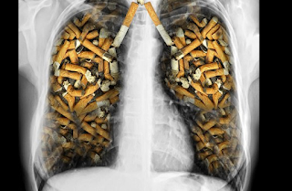 Pulisci i polmoni dalla nicotina e dalle sostanze nocive e smetti di tossire.