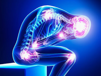 Neuropathic pain is caused by damage or injury to the nerves that transfer information between the brain and spinal cord from the skin, muscles, and other parts of the body.