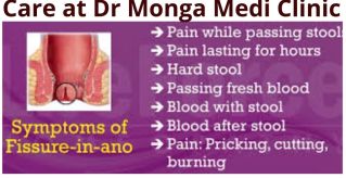 https://drmongaclinic.com/fistula-piles-treatment.html