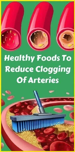 Healthy Foods To Reduce Clogging Of Arteries