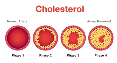 Cholesterol