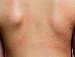 Best Dermatology Skin Care Doctor Information | Rajshahi Medical