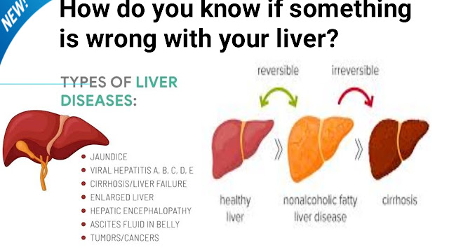 liver disease symptoms,What are the first signs of a bad liver?, Can liver disease be cured?,Where do you feel liver pain?,14 signs liver damage,Early symptoms of liver disease,Liver function ,Liver diseases list,Woman liver failure symptoms,Liver disease treatment,Liver failure stages,Liver pain symptoms