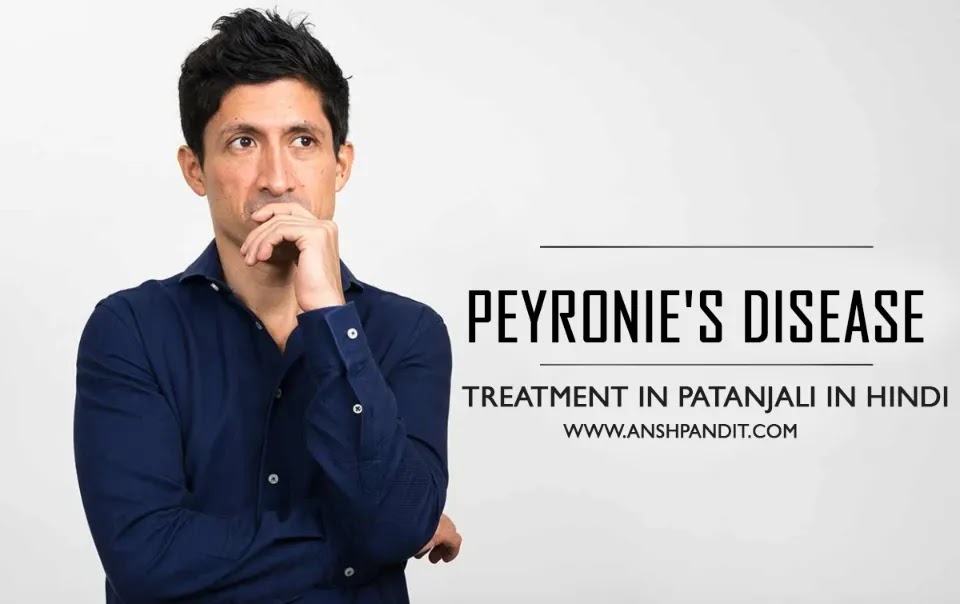 Peyronie's Disease Treatment in Patanjali in Hindi