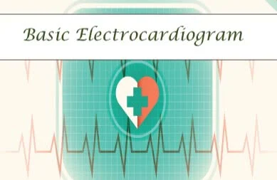 شرح ecg بالعربي pdf