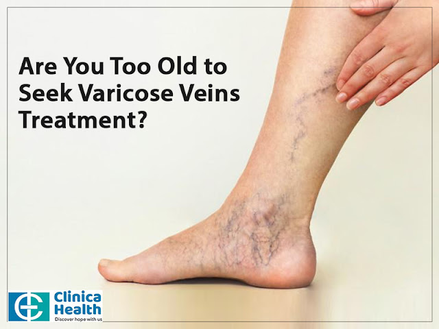 varicose veins specialist in kolkata