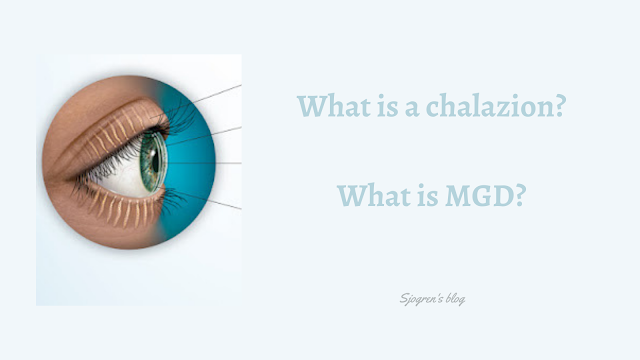 What is a chalazion? and what is MGD?