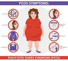 Polycystic Ovary Syndrome (PCOS)