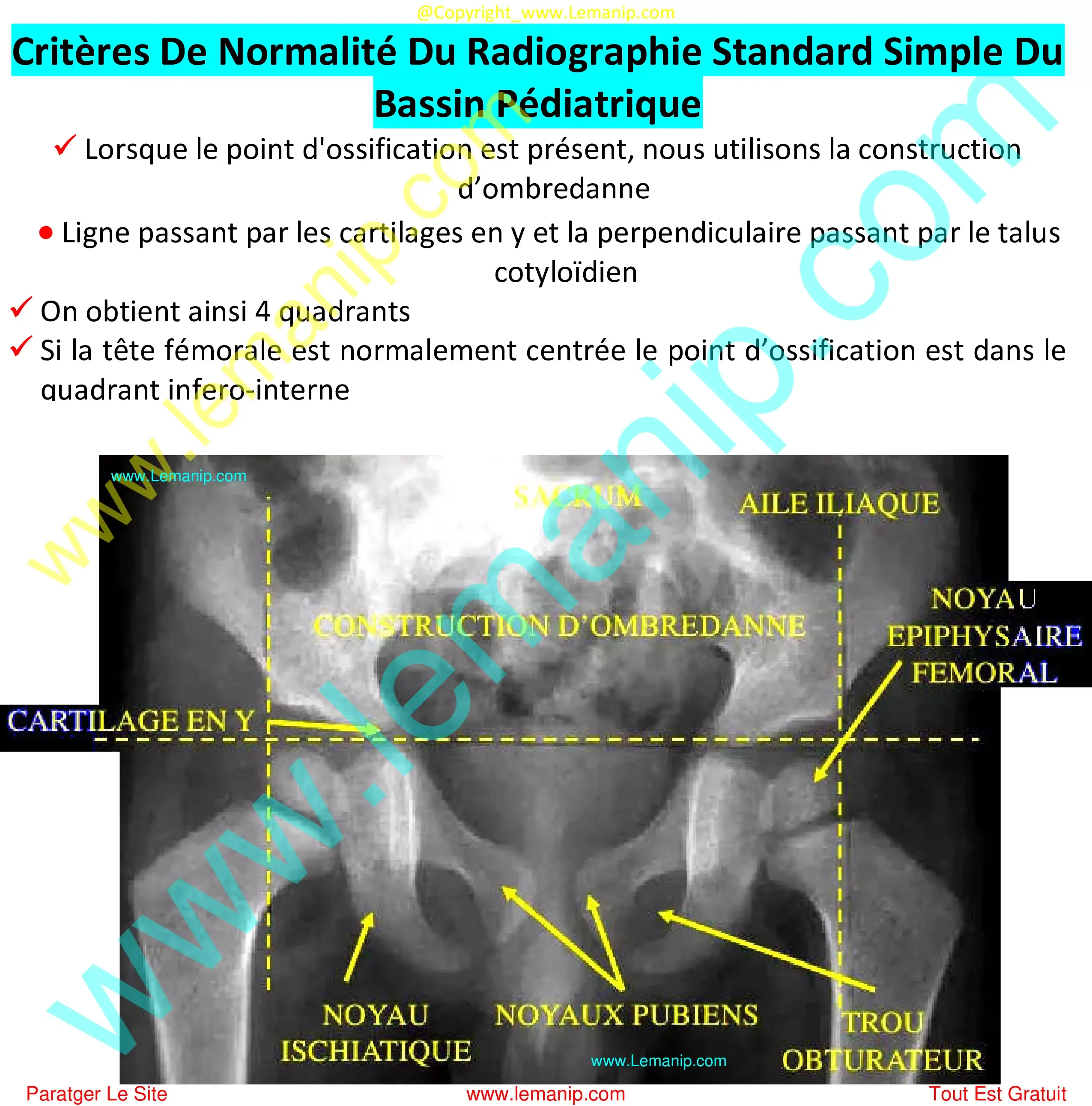 scoliosis hips uneven,hip abductor tear treatment,congenital hip dislocation,snapping hip syndrome surgery,subchondral fracture hip treatment,bilateral hip dysplasia infant,partial hip replacement after fracture,left hip impingement syndrome,avulsion fracture hip treatment,hip fracture surgery to connect broken bones internal fixation