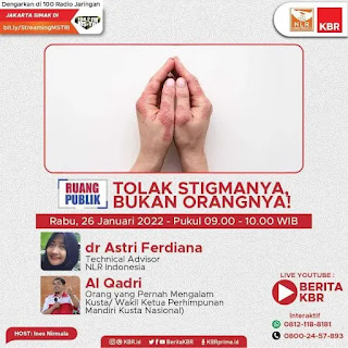 talkshow KBR terkait kusta di streaming youtube