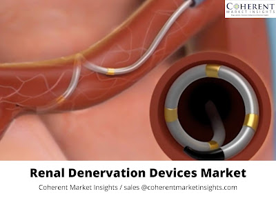 Renal denervation Market Is About To Boom In 2027 And Returning Years
