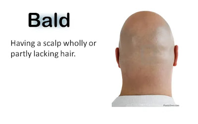 Hairstyle Vocabulary: Bald