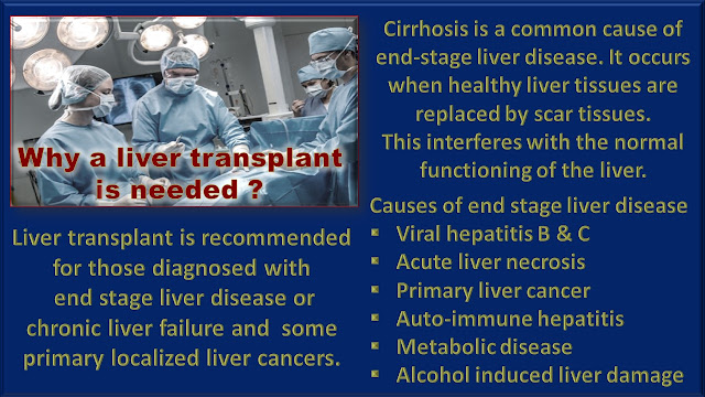 Why a liver transplant is needed?