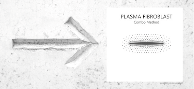 Plasma fibroblast Combo technique