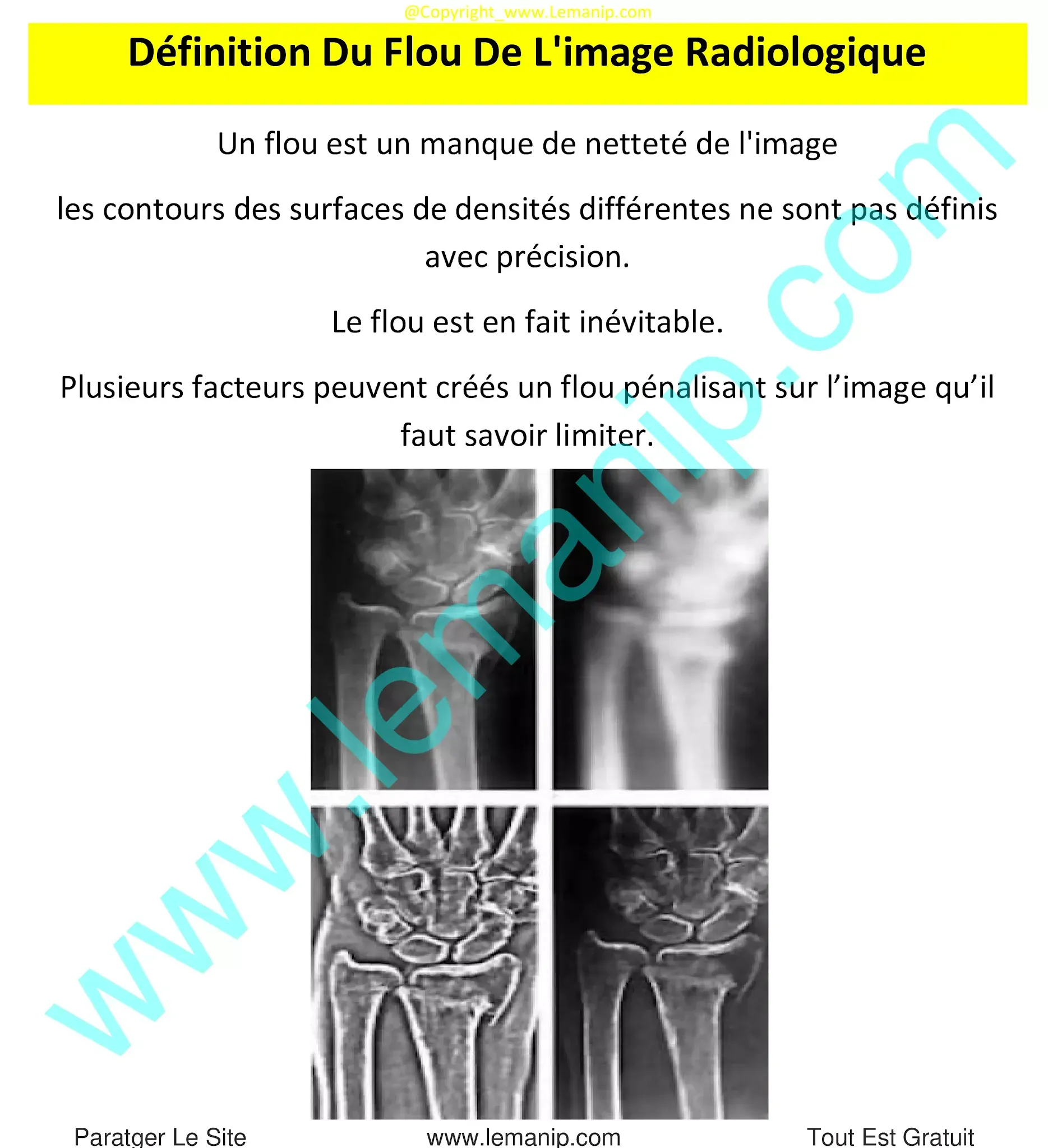 Définition Du Flou De L'image Radiologique