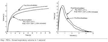 Espirometría o curva de flujo volumen pre y post broncodilatadores