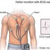 What Can Holter ECG Do?