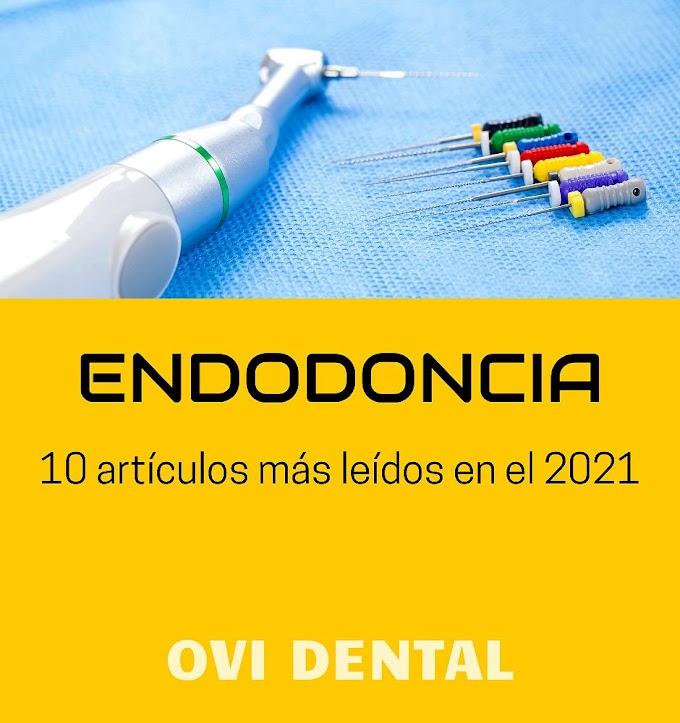 ENDODONCIA: 10 artículos más leídos en el 2021