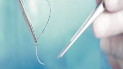 A surgical suture is one of the most common medical devices used by doctors during surgery. After an accident or surgery, a suture keeps the body's tissues together by maintaining their structural integrity, or holding them together as required.