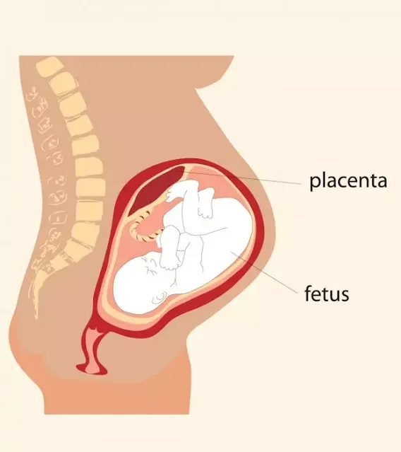 Placental-Abruption-Causes-Symptoms-And-Treatment