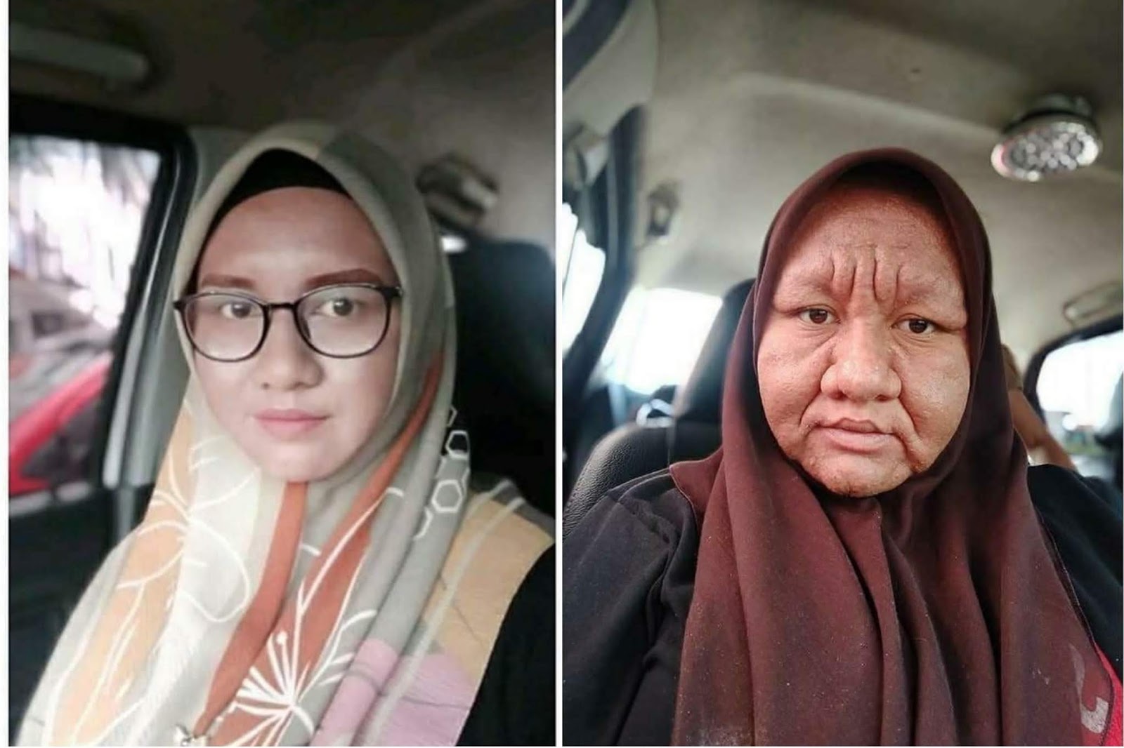 Viral Wajah Wanita Ini Terlihat Tua Saat Hamil, Keriput Bengkak dan