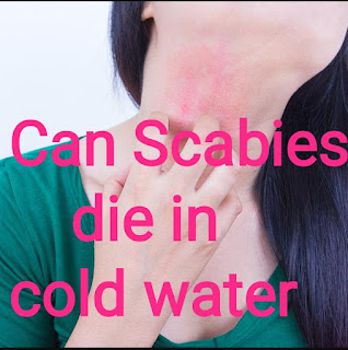 Can Scabies die in cold water