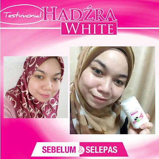 Vitamin C Hadzra White 