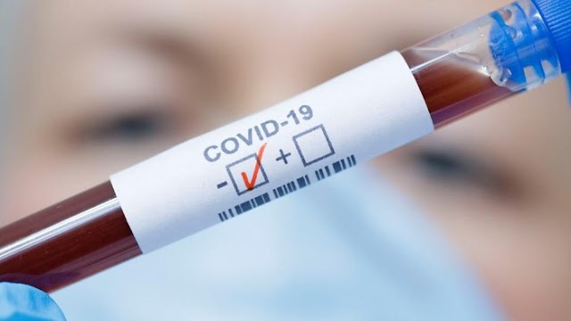 Viral Obat Cina COVID-19 Lianhua Qingwen Dilarang Beredar, Ini Penegasan BPOM