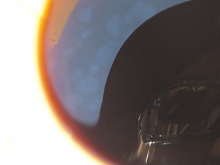 034dev-DSCF4276