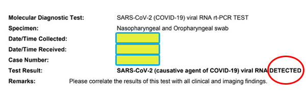 covid positive result